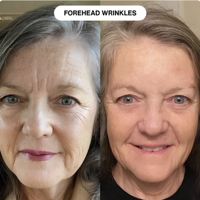 Nelival™ Line Filler Primer