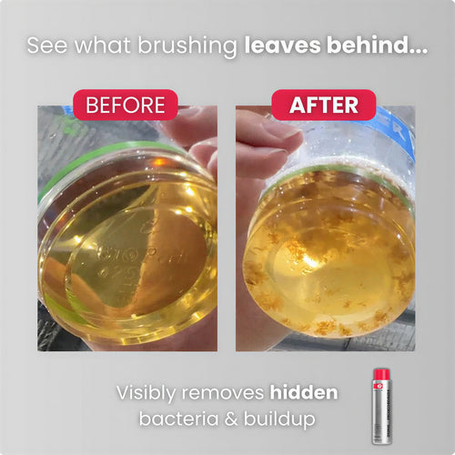 ID Stain Mouthwash