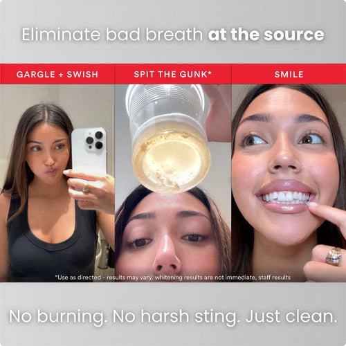 ID Stain Mouthwash