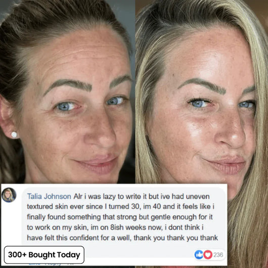 Calcium Multi Balm