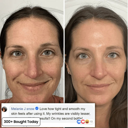 Calcium Multi Balm