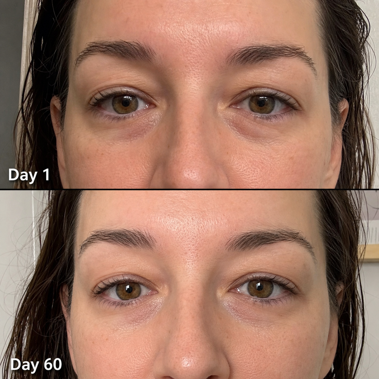 Day 1 and Day 60 skin comparison